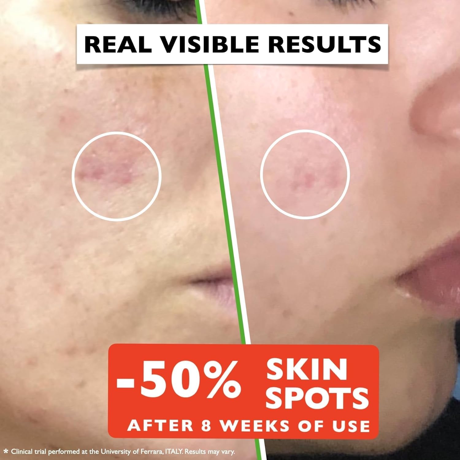 Vitamin C Serum For Face β Anti-Aging Facial Serum with Vitamin C, Hyaluronic Acid, Niacinamide, B5 & Vit E. Brightening Facial Essence for Dark Spots, Fine Lines, Wrinkles & Glowing Skin, 2 Fl Oz