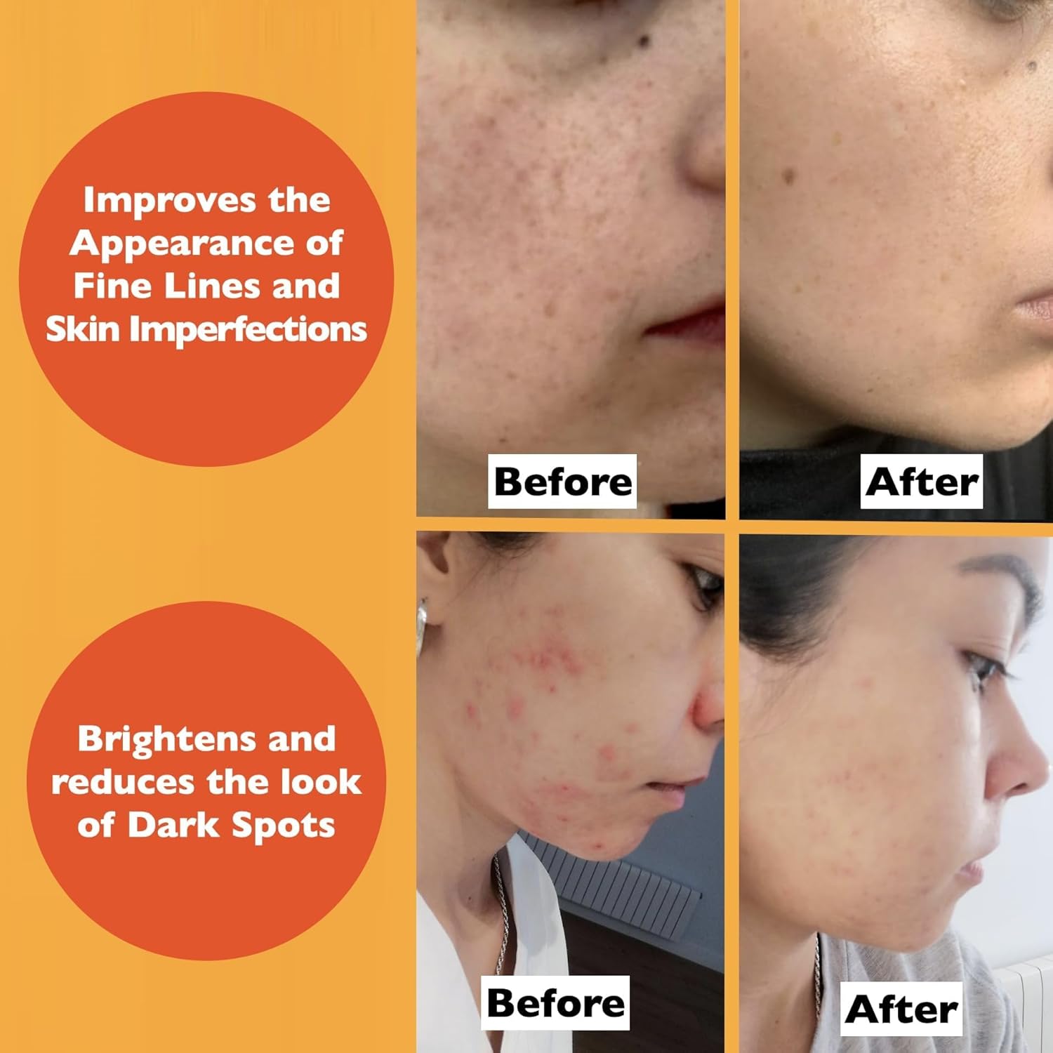 Vitamin C Serum For Face – Anti-Aging Facial Serum with Vitamin C, Hyaluronic Acid, Niacinamide, B5 & Vit E. Brightening Facial Essence for Dark Spots, Fine Lines, Wrinkles & Glowing Skin, 2 Fl Oz
